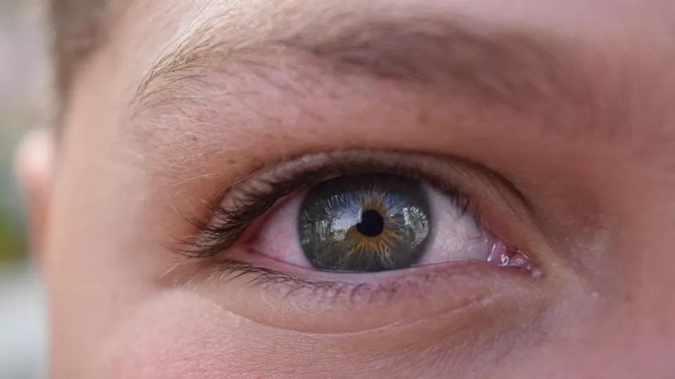 No todos son aptos para usar lentes de contacto, mejor visita al oftalmólogo para una valoración