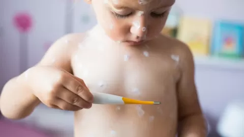 Alerta nacional por repunte de virus coxsackie: urge extremar precauciones en varias regiones