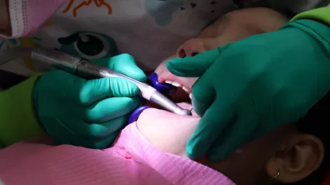 ¡No es solo estética! El sarro causa pérdida de hueso y enfermedades periodontales severas; es necesario prevenirlo desde la infancia