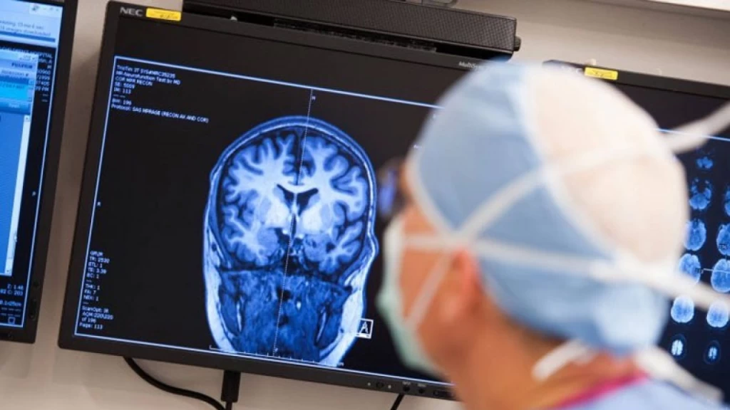 Epilepsia: Rompiendo el Silencio y el Estigma Social - Expertos Urgen a Eliminar Prejuicios para Mejorar la Calidad de Vida de los Pacientes