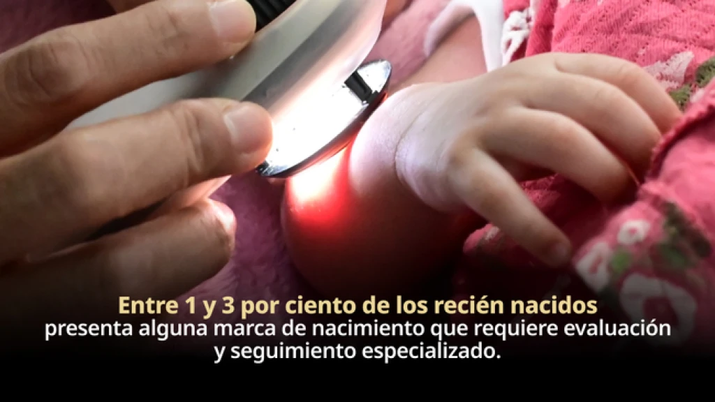 Entre 1 y 3 por ciento de los recién nacidos presenta alguna marca de nacimiento que requiere evaluación y seguimiento especializado