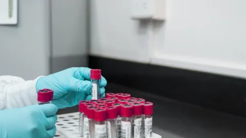OMS Exige Respuestas a Rusia tras Muerte en Laboratorio Siberiano por Posible Peste Neumónica